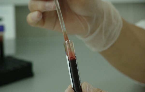 Blood in a phial is being tested by a technician wearing latex gloves